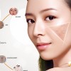 青海祛斑祛痘品牌|郑州美泰化妆品提供口碑好的祛斑祛痘加盟