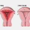 临朐卵巢性不孕专科（show time）卵巢性不孕如何预防？