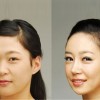 双眼皮手术费用-广东可靠的割双眼皮推荐